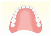 入れ歯・義歯の種類 総入れ歯